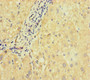 Immunohistochemistry of paraffin-embedded human liver cancer using CAC07667 at dilution of 1:100