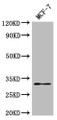 Western Blot; , Positive WB detected in: MCF-7 whole cell lysate; , All lanes: RSPH9 antibody at 1:2000; , Secondary; , Goat polyclonal to rabbit IgG at 1/50000 dilution; , Predicted band size: 32, 35 kDa; , Observed band size: 32 kDa;