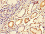 Immunohistochemistry of paraffin-embedded human gastric cancer using CAC07681 at dilution of 1:100