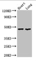 Western Blot; , Positive WB detected in: Mouse heart tissue, Mouse lung tissue; , All lanes: PAG1 antibody at 3µg/ml; , Secondary; , Goat polyclonal to rabbit IgG at 1/50000 dilution; , Predicted band size: 47 kDa; , Observed band size: 47 kDa;