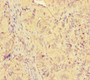 Immunohistochemistry of paraffin-embedded human adrenal gland tissue using CAC07690 at dilution of 1:100