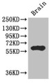 Western Blot; , Positive WB detected in: Mouse brain tissue; , All lanes: ICE1 antibody at 2.7µg/ml; , Secondary; , Goat polyclonal to rabbit IgG at 1/50000 dilution; , Predicted band size: 68 kDa; , Observed band size: 68 kDa;