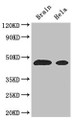 Western Blot; Positive WB detected in: Mouse brain tissue, Hela whole cell lysate; All lanes: ASS1 antibody at 3µg/ml; Secondary; Goat polyclonal to rabbit IgG at 1/50000 dilution; Predicted band size: 47 kDa; Observed band size: 47 kDa