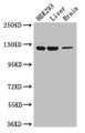 Western Blot; , Positive WB detected in: HEK293 whole cell lysate, Mouse liver tissue, Mouse brain tissue; , All lanes: GUCY2C antibody at 3.4µg/ml; , Secondary; , Goat polyclonal to rabbit IgG at 1/50000 dilution; , Predicted band size: 124 kDa; , Observed band size: 124 kDa;