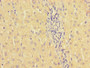 Immunohistochemistry of paraffin-embedded human liver cancer using CAC07710 at dilution of 1:100