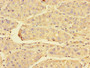 Immunohistochemistry of paraffin-embedded human liver cancer using CAC07720 at dilution of 1:100