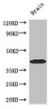 Western Blot; Positive WB detected in: Mouse brain tissue; All lanes: SPDEF antibody at 3µg/ml; Secondary; Goat polyclonal to rabbit IgG at 1/50000 dilution; Predicted band size: 38, 36 kDa; Observed band size: 38 kDa;