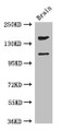 Western Blot; Positive WB detected in: Mouse brain tissue; All lanes: PREX2 antibody at 3.4µg/ml; Secondary; Goat polyclonal to rabbit IgG at 1/50000 dilution; Predicted band size: 183, 172, 113 kDa; Observed band size: 183, 113 kDa;