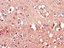 Immunohistochemistry of paraffin-embedded human brain tissue using CAC07738 at dilution of 1:100