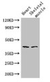 Western Blot; Positive WB detected in: Mouse heart tissue, Mouse skeletal muscle tissue; All lanes: SLC30A7 antibody at 3µg/ml; Secondary; Goat polyclonal to rabbit IgG at 1/50000 dilution; Predicted band size: 42 kDa; Observed band size: 42 kDa;