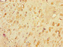 Immunohistochemistry of paraffin-embedded human placenta tissue using CAC07740 at dilution of 1:100