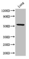 Western Blot; Positive WB detected in: Mouse lung tissue; All lanes: Q9NQ4 antibody at 3.2µg/ml; Secondary; Goat polyclonal to rabbit IgG at 1/50000 dilution; Predicted band size: 51, 46 kDa; Observed band size: 51 kDa;