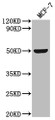 Western Blot; , Positive WB detected in: MCF-7 whole cell lysate; , All lanes: SLC52A3 antibody at 1:2000; , Secondary; , Goat polyclonal to rabbit IgG at 1/50000 dilution; , Predicted band size: 51, 46 kDa; , Observed band size: 51 kDa;