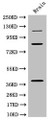 Western Blot; Positive WB detected in: Mouse brain tissue; All lanes: PDZRN3 antibody at 3µg/ml; Secondary; Goat polyclonal to rabbit IgG at 1/50000 dilution; Predicted band size: 120, 39, 81 kDa; Observed band size: 120, 81, 39 kDa;