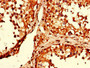 Immunohistochemistry of paraffin-embedded human testis tissue using CAC07755 at dilution of 1:100