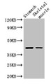 Western Blot; Positive WB detected in: Mouse stomach tissue, Mouse skeletal muscle tissue; All lanes: AGTR1 antibody at 3µg/ml; Secondary; Goat polyclonal to rabbit IgG at 1/50000 dilution; Predicted band size: 42 kDa; Observed band size: 42 kDa;