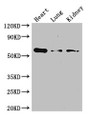 Western Blot; Positive WB detected in: Mouse heart tissue, Mouse lung tissue, Mouse kidney tissue; All lanes: Gcgr antibody at 3µg/ml; Secondary; Goat polyclonal to rabbit IgG at 1/50000 dilution; Predicted band size: 55 kDa; Observed band size: 55 kDa;