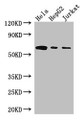 Western Blot; Positive WB detected in: Hela whole cell lysate, HepG2 whole cell lysate, Jurkat whole cell lysate; All lanes: HPSE antibody at 3µg/ml; Secondary; Goat polyclonal to rabbit IgG at 1/50000 dilution; Predicted band size: 62, 55, 54, 43 kDa; Observed band size: 62 kDa;