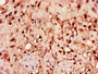 Immunohistochemistry of paraffin-embedded human placenta tissue using CAC07770 at dilution of 1:100