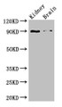 Western Blot; Positive WB detected in: Mouse kidney tissue, Mouse brain tissue; All lanes: IL4 antibody at 3µg/ml; Secondary; Goat polyclonal to rabbit IgG at 1/50000 dilution; Predicted band size: 18, 16 kDa; Observed band size: 90 kDa;