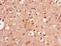 Immunohistochemistry of paraffin-embedded human brain tissue using CAC07773 at dilution of 1:100