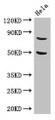 Western Blot; Positive WB detected in: Hela whole cell lysate; All lanes: KBTBD6 antibody at 3.4µg/ml; Secondary; Goat polyclonal to rabbit IgG at 1/50000 dilution; Predicted band size: 77 kDa; Observed band size: 77 kDa