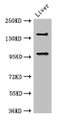 Western Blot; Positive WB detected in: Mouse liver tissue; All lanes: PHLDB2 antibody at 3µg/ml; Secondary; Goat polyclonal to rabbit IgG at 1/50000 dilution; Predicted band size: 143, 137, 140 kDa; Observed band size: 143, 96 kDa;