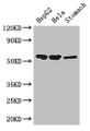 Western Blot; Positive WB detected in: HepG2 whole cell lysate, Hela whole cell lysate, Mouse stomach tissue; All lanes: SLC37A2 antibody at 3µg/ml; Secondary; Goat polyclonal to rabbit IgG at 1/50000 dilution; Predicted band size: 55, 43, 14 kDa; Observed band size: 55 kDa;