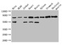 Western Blot; Positive WB detected in: Hela whole cell lysate, HL60 whole cell lysate, Jurkat whole cell lysate, Mouse heart tissue, Mouse brain tissue, Mouse spleen tissue, Mouse stomach tissue, Mouse skeletal muscle tissue; All lanes: SENP1 antibody at 2.7µg/ml; Secondary; Goat polyclonal to rabbit IgG at 1/50000 dilution; Predicted band size: 74 kDa; Observed band size: 74, 50 kDa;