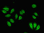 Immunofluorescent analysis of A549 cells using CAC07824 at dilution of 1:100 and Alexa Fluor 488-congugated AffiniPure Goat Anti-Rabbit IgG(H+L)