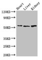 Western Blot; Positive WB detected in: Mouse heart tissue, Mouse liver tissue, Mouse kidney tissue; All lanes: SOX9 antibody at 3µg/ml; Secondary; Goat polyclonal to rabbit IgG at 1/50000 dilution; Predicted band size: 57 kDa; Observed band size: 57 kDa;