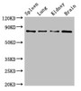 Western Blot; Positive WB detected in: Mouse spleen tissue, Mouse lung tissue, Mouse kidney tissue, Mouse brain tissue; All lanes: PRMT7 antibody at 6.2µg/ml; Secondary; Goat polyclonal to rabbit IgG at 1/50000 dilution; Predicted band size: 79, 63, 74, 64 kDa; Observed band size: 79 kDa;