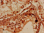 Immunohistochemistry of paraffin-embedded human testis tissue using CAC07835 at dilution of 1:100