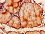 Immunohistochemistry of paraffin-embedded human thyroid tissue using CAC07836 at dilution of 1:100