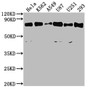 Western Blot; , Positive WB detected in: Hela whole cell lysate, K562 whole cell lysate, A549 whole cell lysate, U87 whole cell lysate, U251 whole cell lysate, 293 whole cell lysate; , All lanes: SNX9 antibody at 1:2000; , Secondary; , Goat polyclonal to rabbit IgG at 1/50000 dilution; , Predicted band size: 67 kDa; , Observed band size: 67 kDa;