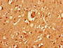 Immunohistochemistry of paraffin-embedded human brain tissue using CAC07837 at dilution of 1:100