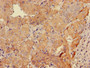 Immunohistochemistry of paraffin-embedded human adrenal gland tissue using CAC07857 at dilution of 1:100