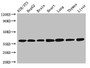 Western Blot; Positive WB detected in: NIH/3T3 whole cell lysate, HepG2 whole cell lysate, Mouse brain tissue, Mouse heart tissue, Mouse lung tissue, Mouse thymus tissue, Rat liver tissue; All lanes: LDHC antibody at 3.2µg/ml; Secondary; Goat polyclonal to rabbit IgG at 1/50000 dilution; Predicted band size: 37 kDa; Observed band size: 37 kDa;