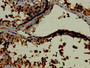 Immunohistochemistry of paraffin-embedded human testis tissue using CAC07867 at dilution of 1:100