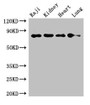 Western Blot; Positive WB detected in: Raji whole cell lysate, Mouse kidney tissue, Rat heart tissue, Rat lung tissue; All lanes: PECAM1 antibody at 2.7µg/ml; Secondary; Goat polyclonal to rabbit IgG at 1/50000 dilution; Predicted band size: 83, 81, 80, 82 kDa; Observed band size: 83 kDa;