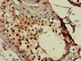 Immunohistochemistry of paraffin-embedded human testis tissue using CAC07911 at dilution of 1:100
