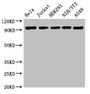 Western Blot; Positive WB detected in: Hela whole cell lysate, Jurkat whole cell lysate, HEK293 whole cell lysate, NIH/3T3 whole cell lysate, A549 whole cell lysate; All lanes: DDR2 antibody at 3.5µg/ml; Secondary; Goat polyclonal to rabbit IgG at 1/50000 dilution; Predicted band size: 97 kDa; Observed band size: 97 kDa;