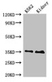 Western Blot; Positive WB detected in: K562 whole cell lysate, Rat kidney tissue; All lanes: TRADD antibody at 4µg/ml; Secondary; Goat polyclonal to rabbit IgG at 1/50000 dilution; Predicted band size: 35, 28 kDa; Observed band size: 35 kDa;