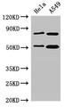Western Blot; Positive WB detected in: Hela whole cell lysate, A549 whole cell lysate; All lanes: SNX27 antibody at 3.5µg/ml; Secondary; Goat polyclonal to rabbit IgG at 1/50000 dilution; Predicted band size: 62, 60, 51 kDa; Observed band size: 51 kDa