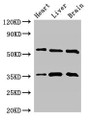 Western Blot; Positive WB detected in: Mouse heart tissue, Mouse liver tissue, Mouse brain tissue; All lanes: STK35 antibody at 2.5µg/ml; Secondary; Goat polyclonal to rabbit IgG at 1/50000 dilution; Predicted band size: 59 kDa; Observed band size: 59, 36 kDa;