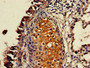 Immunohistochemistry of paraffin-embedded human lung tissue using CAC07936 at dilution of 1:100