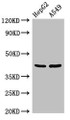 Western Blot; Positive WB detected in: HepG2 whole cell lysate, A549 whole cell lysate; All lanes: PITX2 antibody at 3µg/ml; Secondary; Goat polyclonal to rabbit IgG at 1/50000 dilution; Predicted band size: 36, 31 kDa; Observed band size: 42 kDa