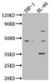 Western Blot; Positive WB detected in: Mouse heart tissue, Mouse spleen tissue, Mouse lung tissue; All lanes: ZKSCAN3 antibody at 4µg/ml; Secondary; Goat polyclonal to rabbit IgG at 1/50000 dilution; predicted band size: 61, 44 kDa; observed band size: 61, 44 kDa;