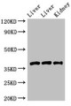 Western Blot; Positive WB detected in: Rat liver tissue, Mouse liver tissue, Mouse kidney tissue; All lanes: GNB4 antibody at 2µg/ml; Secondary; Goat polyclonal to rabbit IgG at 1/50000 dilution; Predicted band size: 38 kDa; Observed band size: 38 kDa;