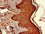 Immunohistochemistry of paraffin-embedded human skin tissue using CAC07954 at dilution of 1:100